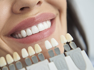 本来のご自身の歯よりも白くしたい方のためのホワイトニング